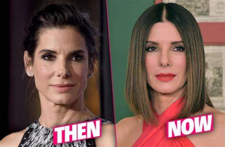 Did Sandra Bullock Have Plastic Surgery? Facial Analysis Cl&iacute;nica de