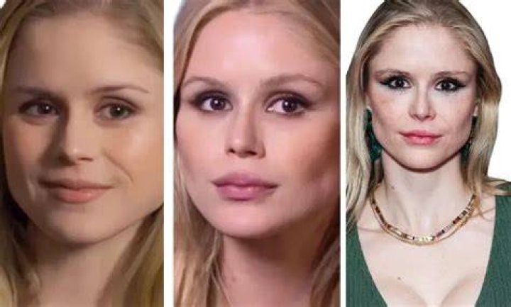 Erin Moriarty Before And After Plastic Surgery Her Transformation Journey