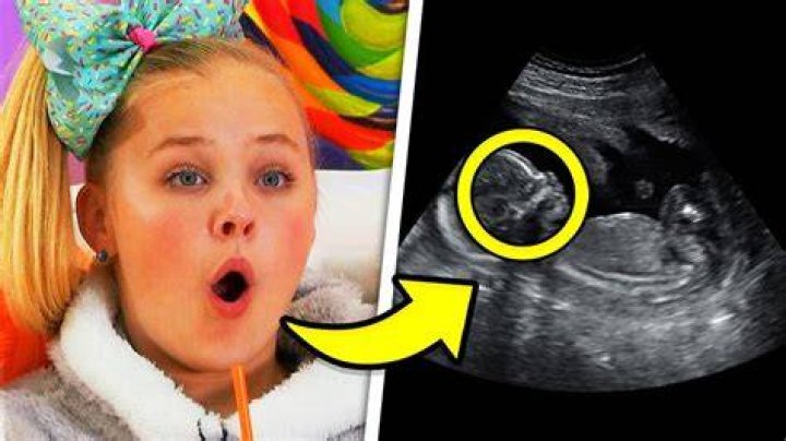 Is JoJo Siwa Really Having a Baby?