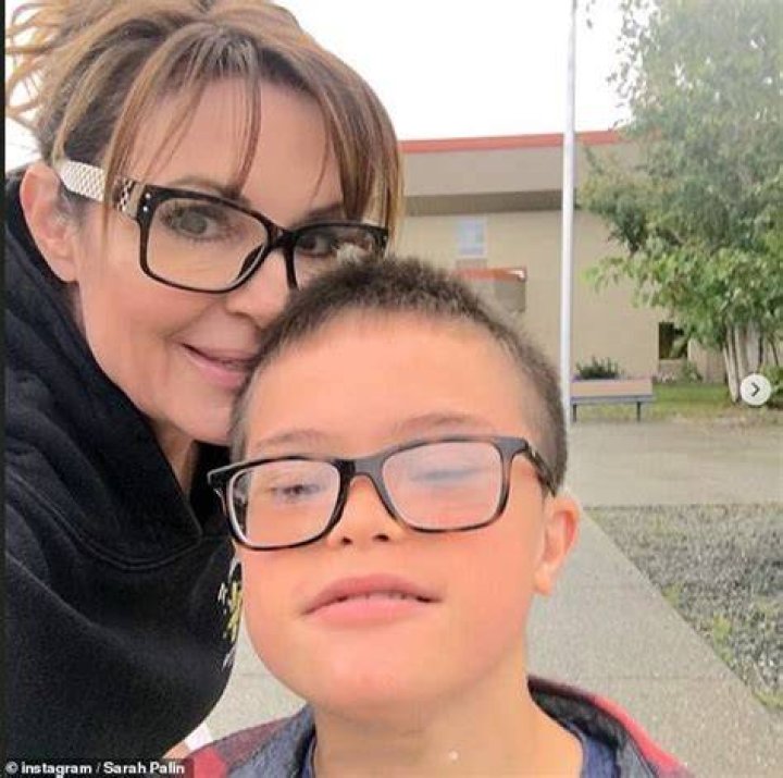 Palin Down syndrome no reason for abortion CNNPolitics