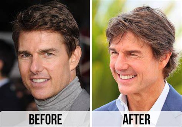 Tom Cruise before and after a nose job. houseandwhips.com